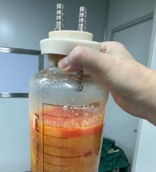 湘潭水动力吸脂手术要做多久？